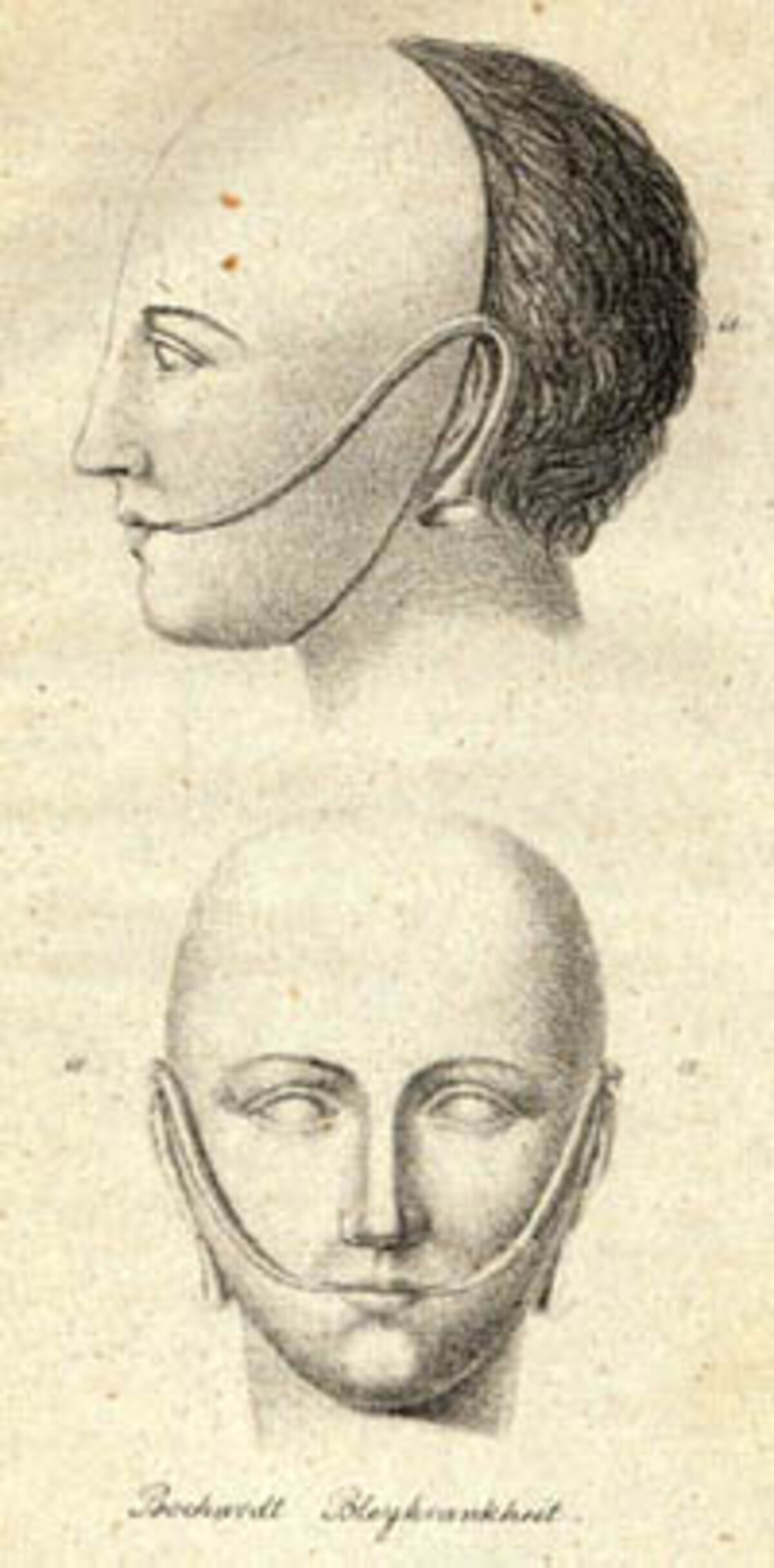 Modell einer Atemschutzmaske von Louis Bochardt; 1825
(Stadtarchiv Heilbronn)